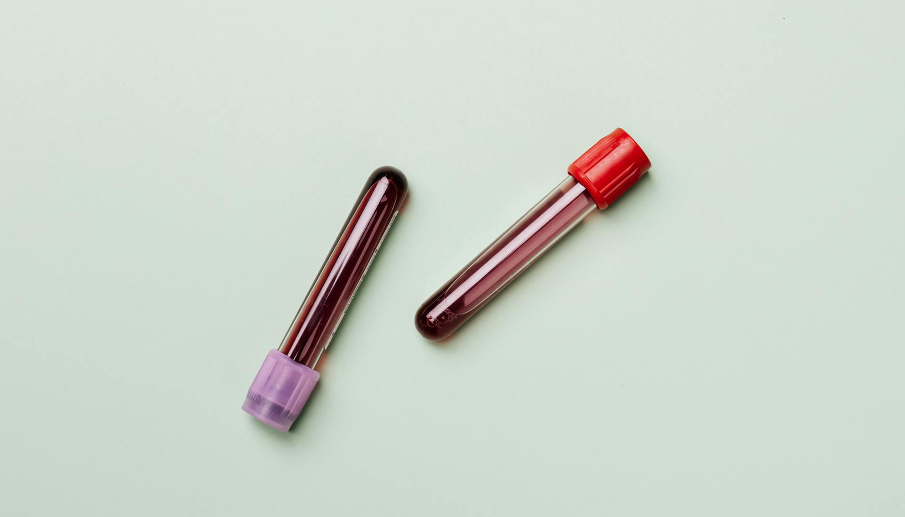 무료 검사 놓치지 않는 단계별 실행 절차